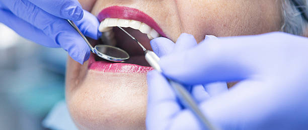 Best Broken or Cracked Tooth Emergency Dentist in Bellmead, TX